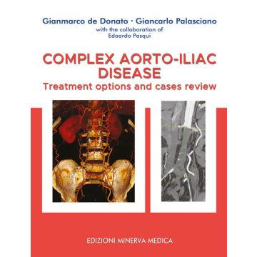 Complex aorto-iliac disease. Treatment options and cases review