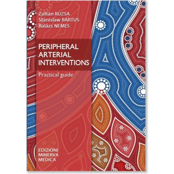 Peripheral arterial interventions. Practical guide