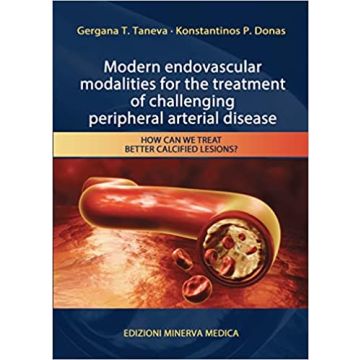 Modern endovascular modalities for the treatment of challenging peripheral arterial disease. How can we treat better calcified lesions?