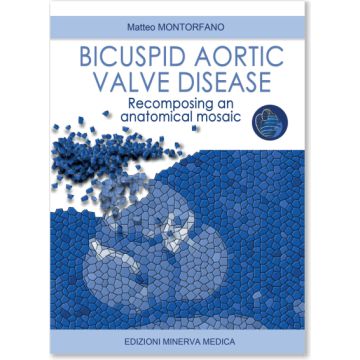 Bicuspid aortic valve disease. Recomposing an anatomical mosaic