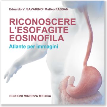 Riconoscere l'esofagite eosinofila. Atlante per immagini (Savarino, Fassan - Minerva medica)
