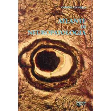 Atlante di Neuropatologia