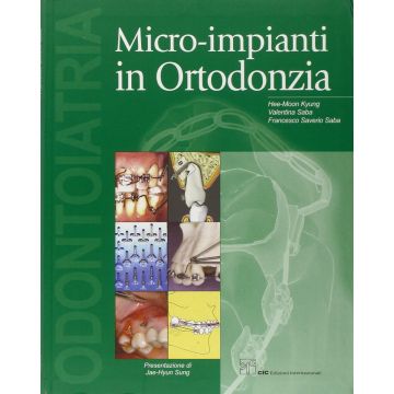 Micro Impianti in Ortodonzia Hee Moon Kyung saba francesco valentina cic edizioni