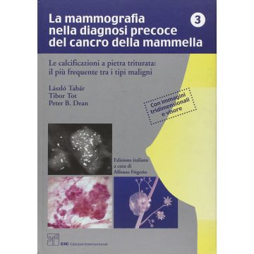 TABAR La Mammografia nella Diagnosi Precoce del Cancro della Mammella 3 - Le calcificazioni a pietra triturata: il più frequente tra i tipi maligni 