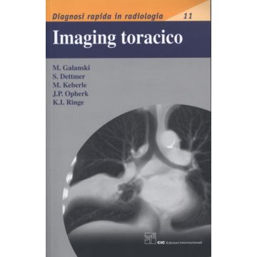 Imaging Toracico