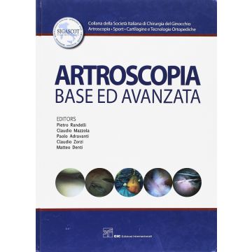 Artroscopia base ed avanzata  [Adravanti; Società Italiana Chirurgia del Ginocchio - CIC Edizioni Internazionali]