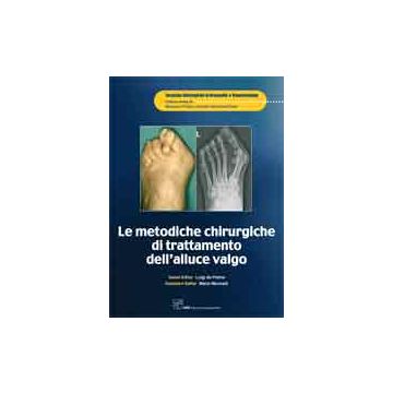 Le metodiche chirurgiche di trattamento dell'alluce valgo