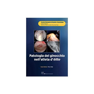 Patologia del ginocchio nell'atleta d'élite