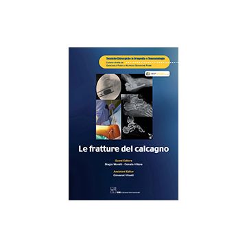 Le Fratture del Calcagno