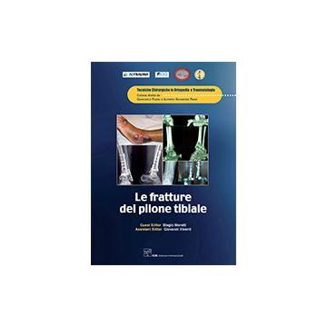 Le Fratture del Pilone Tibiale   [Moretti - CIC Edizioni Internazionali]
