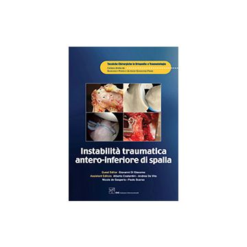 Instabilità traumatica antero-inferiore di spalla  AA.VV.  CIC Edizioni Internazionali  9788871419893