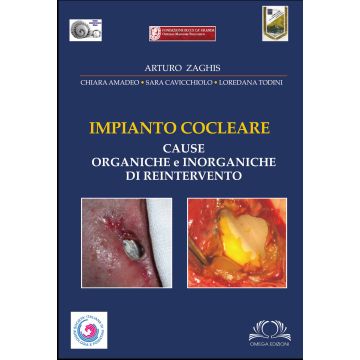 Impianto Cocleare - Cause Organiche e Inorganiche di reintervento   [Zaghis - Omega Edizioni]
