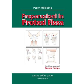 Preparazioni in Protesi Fissa