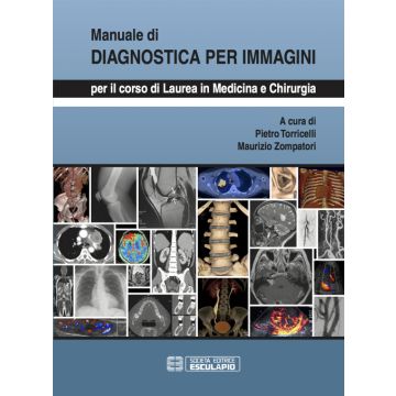 Manuale di Diagnostica per Immagini. Per i corsi di laurea in Medicina e Chirurgia  Torricelli Pietro; Zompatori Maurizio  Esculapio  9788874889198