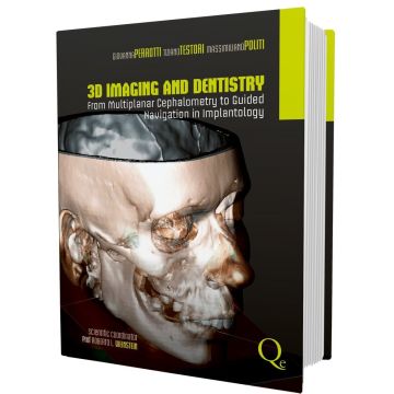 3D Imaging and Dentistry. From Multiplanar Cephalometry to Guided Navigation in Implantology [Perrotti; Testori; Politi - Quintessenza]