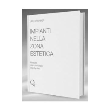 Impianti nella zona estetica. Manuale di implantologia step by step  Grunder Ueli  Quintessenza Edizioni  9788874920334
