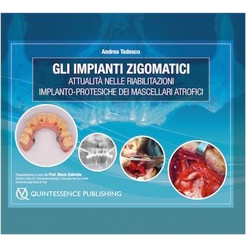 Gli Impianti Zigomatici Attualità nelle riabilitazioni implanto-protesiche dei mascellari atrofici