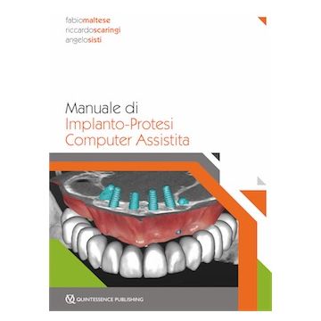 Manuale di Implanto-Protesi Computer Assistita