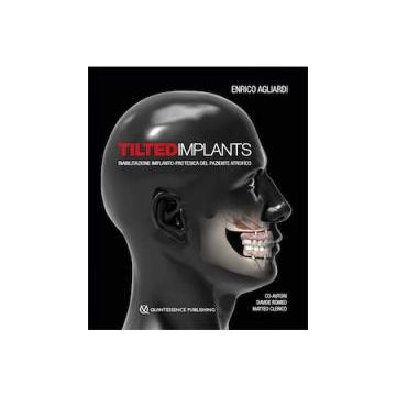 Tilted Implants - Riabilitazione implanto-protesica del paziente atrofico Agliardi, Romeo Quintessenza