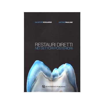Restauri diretti nei settori posteriori