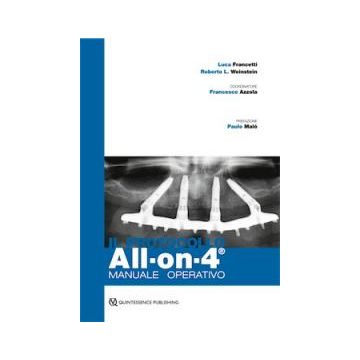 All on 4 manuale operativo luca francetti Roberto Weinstein quintessenza