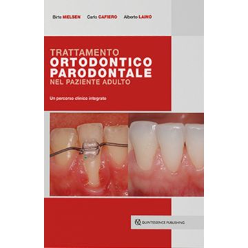 Trattamento ortodontico parodontale nel paziente adulto. Un percorso clinico integrato
