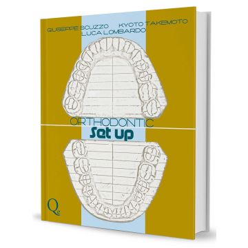 Orthodontic setup