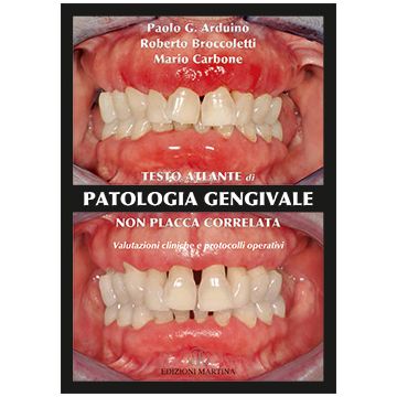 Testo Atlante di Patologia Gengivale non Placca Correlata - Valutazioni Cliniche e Protocolli Operativi [Paolo Arduino; Broccoletti - Martina Edizioni]