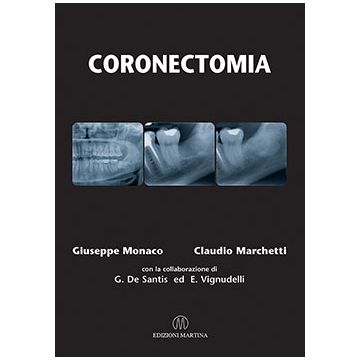 Coronectomia    [Monaco - Martina Edizioni]
