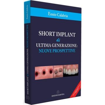 Short implant di ultima generazione: nuove prospettive. Con QR Code