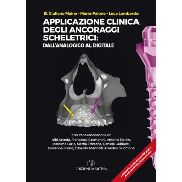 Applicazione clinica degli Ancoraggi Scheletrici: dall’analogico al digitale  [Maino Giuliano; Palone Mario; Lombardo Luca - Martina edizioni]