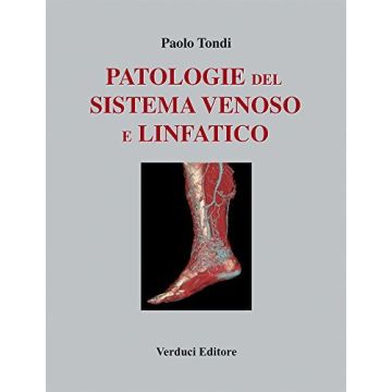 Patologie del Sistema Venoso e Linfatico    [Tondi  - Verduci Editore]