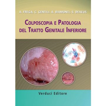 Colposcopia e Patologia del Tratto Genitale Inferiore   [Frega - Verduci Editore]