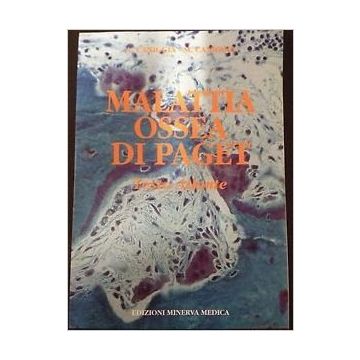 Malattia ossea di Paget (Osteitis Deformans) Testo Atlante  [Caniggia - Minerva Medica]