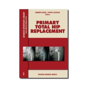 Primary Total Hip Replacement N. 3