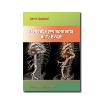Recent developments in T/EVAR