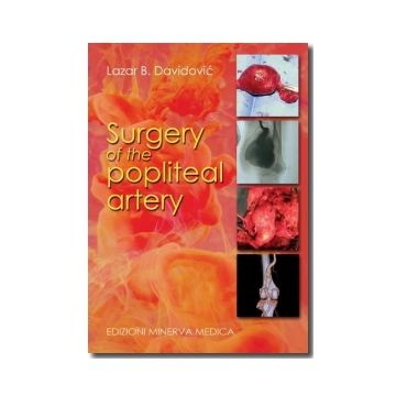 Surgery of the popliteal artery