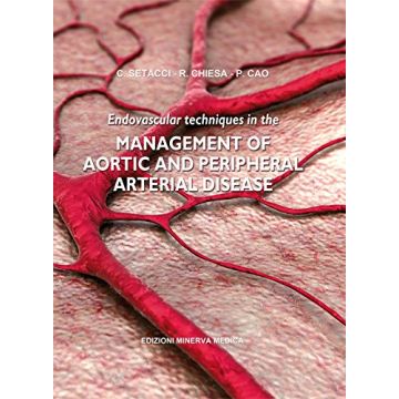 Endovascular techniques in the management of aortic and peripheral arterial disease  Setacci Carlo; Chiesa Roberto; Cao Piergiorgio  Minerva Medica  9788877118561