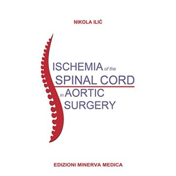 Ischemia of the spinal cord in aortic surgery  Ilic Nikola  Minerva Medica  9788877118653