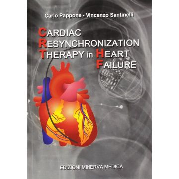 Cardiac Resynchronization Therapy in heart failure