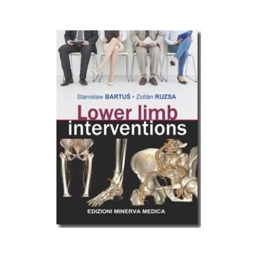 Lower limb interventions