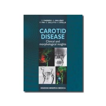 Carotid disease - Clinical and morphological insights