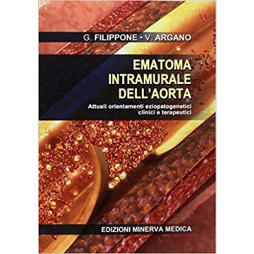 Filippone Argano Ematoma intramurale dell'aorta