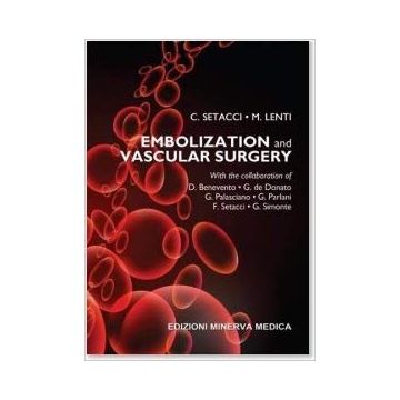 Embolization and vascular surgery