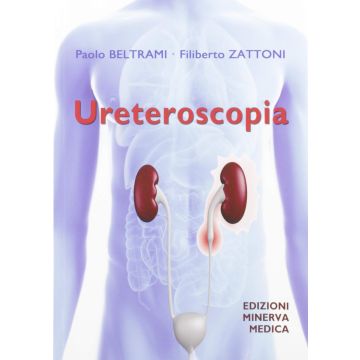 Ureteroscopia  [Beltrami, Zattoni - Minerva Medica] 