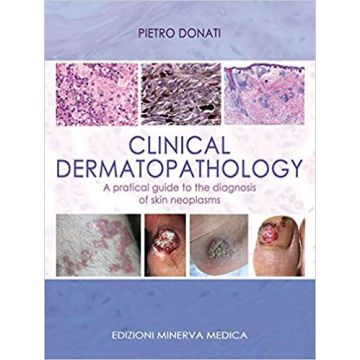 Clinical dermatopathology A pratical guide to the diagnosis of skin neoplasms