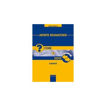 Artrite reumatoide. Come e dove curarsi  AA.VV.  Pacini Editore  9788877819642