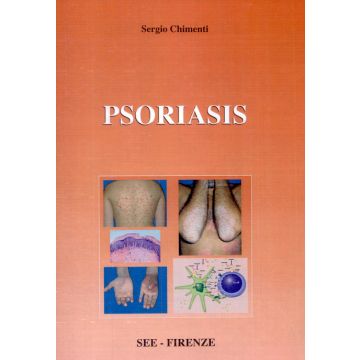 Psoriasis  [Chimenti Fabbri- See Editrice Acta Medica]