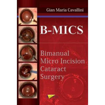 B-MICS Bimanual Micro Incision Cataract Surgery   [Cavallini - Athena]
