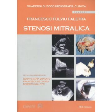 Quaderni di ecocardiografia clinica. Vol. 3: Stenosi mitralica